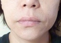 PAO�̌���(Befor)